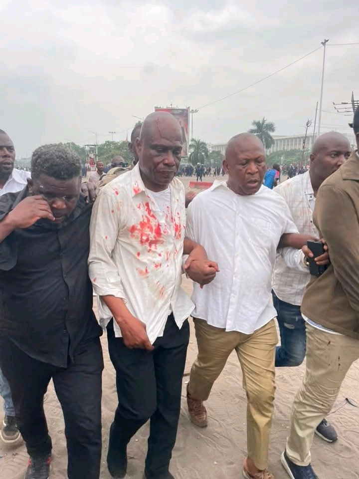 Répression musclée à Kinshasa : L&rsquo;opposition face à la violence policière